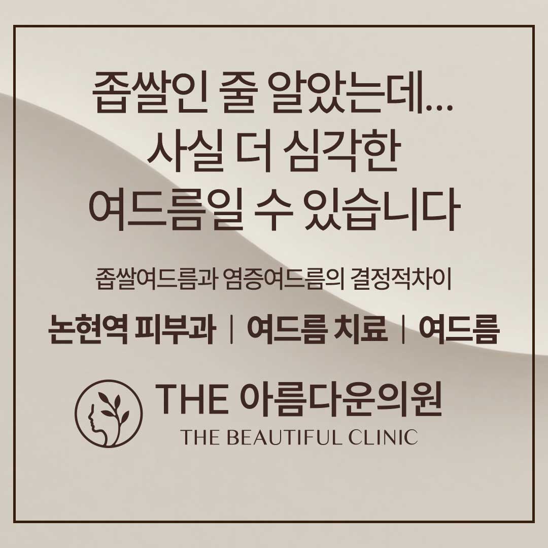 여드름, 좁쌀여드름, 염증여드름, 여드름차이, 여드름치료, 여드름치료후기, 논현역피부과, 더아름다운의원 
