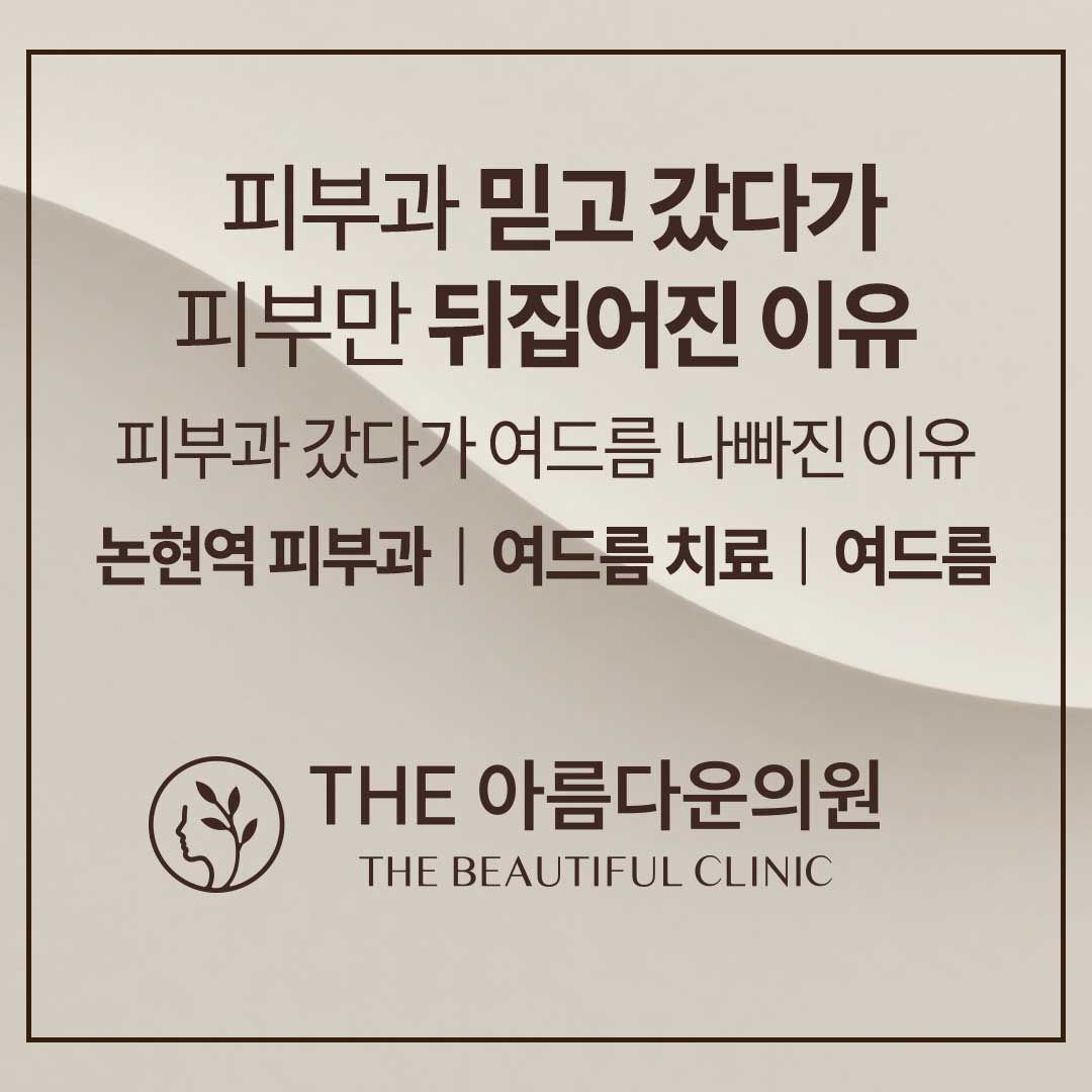 여드름, 여드름치료, 강남역 피부과, 포텐자, 여드름흉터치료, 여드름치료부작용, 여드름부작용, 여드름치료효과, 여드름치료주기, 여드름나는이유, 논현역피부과, 논현동피부과, 더아름다운의원, 여드름치료병원, 여드름치료부작용, 골드PTT, 골드피티티, 아그네스, 브이빔퍼펙타, 브이빔 