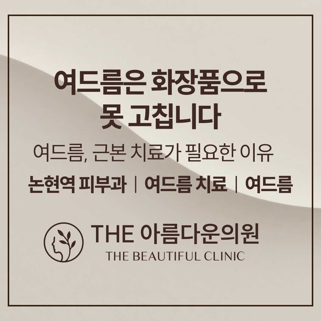 여드름 치료가 화장품으로 어렵다는 이미지, 여드름, 여드름화장품, 여드름화장품부작용, 여드름원인, 여드름원인치료, 여드름차이, 여드름치료, 여드름치료후기, 논현역피부과더아름다운의원