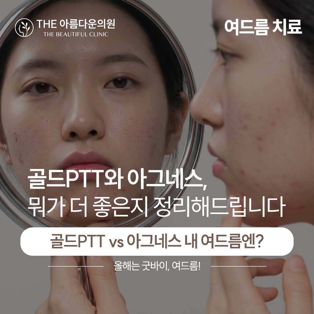 关于代表性痘痘皮脂腺治疗Agnes与黄金PTT区别的说明, 黄金PTT, Agnes, 皮脂腺治疗, 致美丽thebeautiful, 论岘站皮肤科
